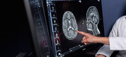 Imagen de  Hospital Infantil San Vicente Fundación, referente nacional en neurocirugía pediátrica avanzada