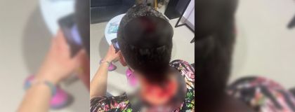 Imagen de  Con varias heridas en su cuerpo quedó conductor que fue víctima de intento de hurto en Rionegro