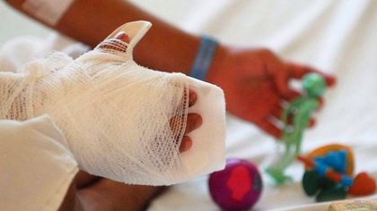 Imagen de  El Oriente sumó dos lesionados por pólvora