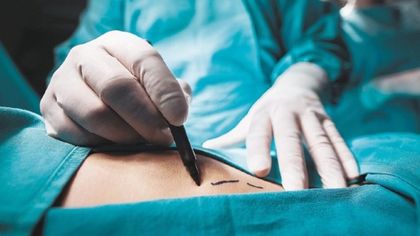 Imagen de Grupo de búsqueda perseguirá a quienes realicen procesos estéticos irregulares en Antioquia