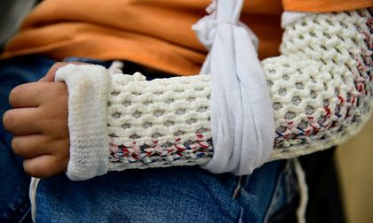 ¿Por qué casi la mitad de los niños sufrirá una fractura antes de la adolescencia?