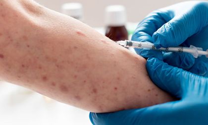 Brotes de sarampión aumentan en 59 países, según la OMS: aún faltan millones de niños por vacunar