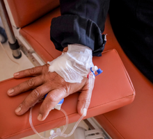 Identifican el ‘escudo’ de fibroblastos que protege al cáncer de hígado muy agresivo de la quimioterapia