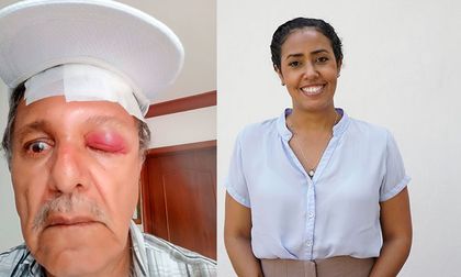 “Cali no puede normalizar la violencia”: Subsecretaria de Cultura Ciudadana, ante caso de adulto mayor agredido por motociclista