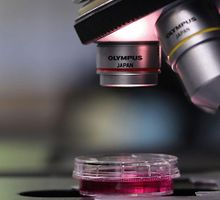 Estudian nueva especie de Babesia ligada a la babesiosis humana