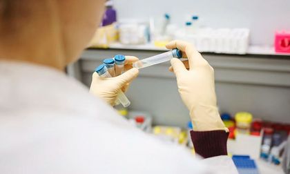 ¿Nueva pandemia? Extraña enfermedad ha dejado 71 muertos, vea qué se sabe hasta el momento