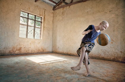 Zawia y el color de su piel