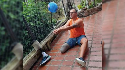 Imagen de “Mi salud mental y física se está deteriorando”: docente de Rionegro lleva dos años esperando una nueva prótesis