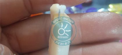 Imagen de  Horror en Halloween: madre denunció que su hija recibió dulces con agujas en Marinilla