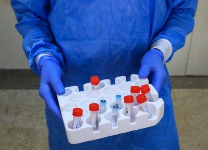 Hombre de entre 25 y 35 años: el nuevo positivo de COVID-19 en El Santuario