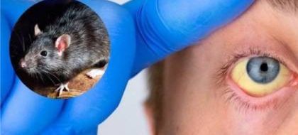 Imagen de  En el Oriente han confirmado dos casos de leptospirosis; Gobernación descarta una epidemia