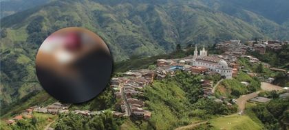 Imagen de ¡Repudiable! Por discusión con un vecino, un hombre ató e hirió gravemente a un perro en Nariño