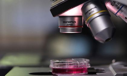 Estudian nueva especie de Babesia ligada a la babesiosis humana