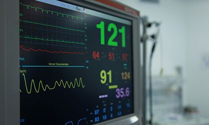 España encabeza el mayor repunte de muertes súbitas en Europa