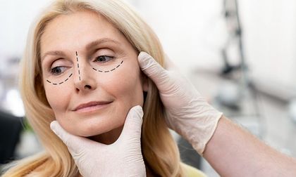 Cirugía para eliminar bolsas en los ojos: una mirada fresca desde Colombia