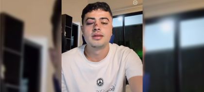 Imagen de Joven denuncia robo con escopolamina y golpiza, al parecer, por un conductor de taxi, cuando salió de Provenza