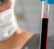 Hiperdiploidia prenatal podría ser el primer paso de la leucemia infantil, según un estudio