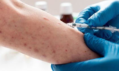 Ministerio de Salud confirma casos de sarampión en Colombia e intensifica la vacunación y la vigilancia epidemiológica