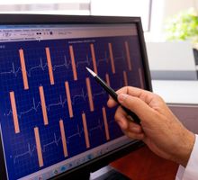 Reparan válvulas mecánicas con catéter sin cirugía abierta