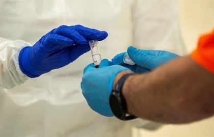 Imagen de  1.949 nuevos casos de COVID-19 en el país y 81 fallecidos