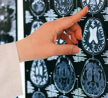 Existe una conexión entre intestino-cerebro y la memoria en la vejez