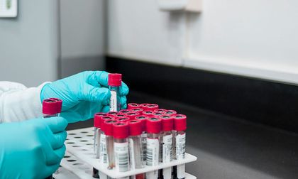 Enfermero enviado a la cárcel por cirugía estética
