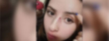 Imagen de  Mujer denuncia agresión en Guarne tras reclamar a vecinos por exceso de ruido y supuesta manipulación de pólvora