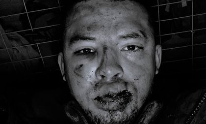 Colombiano denuncia presunto secuestro por parte del Ejército ucraniano