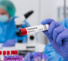 OMS no descarta transmisión humana en brote de hantavirus del crucero MV Hondius