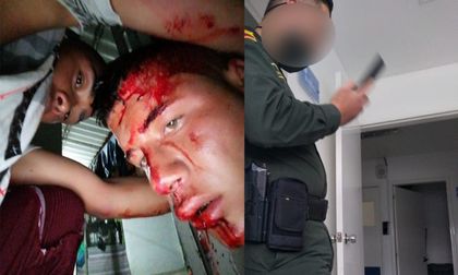 ¿Irrespeto a la Policía? ¿Abuso de fuerza? Dos heridos tras procedimiento policial en Sonsón
