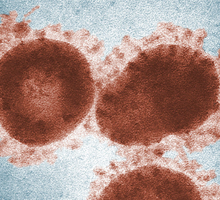 Alerta por brotes de norovirus
