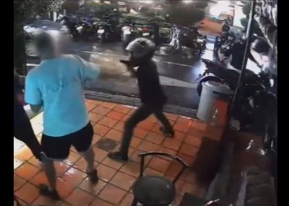 Imagen de Indignación por hombre que recibió disparo en el rostro por oponerse a un hurto 