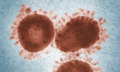 Alerta por brotes de norovirus