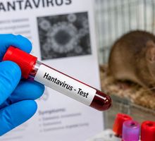 Brote de hantavirus alcanza 12 contagios y mantiene alerta sanitaria