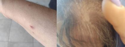 Imagen de Mujer fue atacada por habitante en situación de calle en Rionegro: la golpeó con una botella