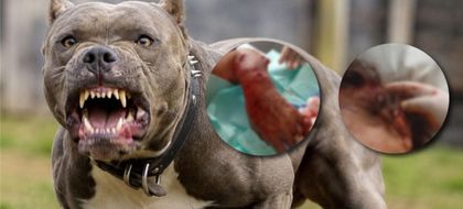 Imagen de Adulta mayor resultó gravemente herida tras ataque de un perro
