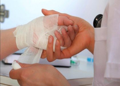 Imagen de Antioquia reporta 10 nuevos casos de quemados por pólvora en Año Nuevo