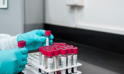 Alerta por extraña enfermedad que produce fiebre, dolor muscular, hemorragia por la nariz