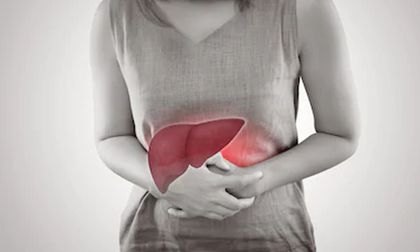 ¿Nació entre 1945 Y 1965? está en riesgo de tener hepatitis C