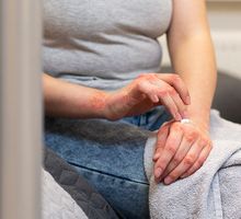 Enfermedades raras en Colombia: 3,5 millones de personas podrían vivir con una