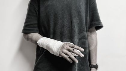 Imagen de Alborada deja 11 lesionados por pólvora en Antioquia, según la Gobernación