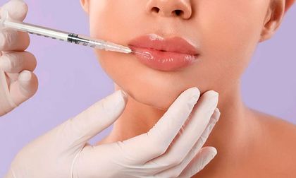 ¿Es seguro aplicarse bótox y tiene beneficios reales?