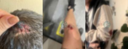 Imagen de Pareja de novios denuncia brutal agresión por parte de vendedores en el Alto de Palmas