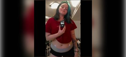 Imagen de Paciente con diabetes suspende bomba de insulina tras 5 meses sin insumos y sin respuesta de Nueva EPS