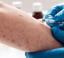 Brotes de sarampión aumentan en 59 países, según la OMS: aún faltan millones de niños por vacunar