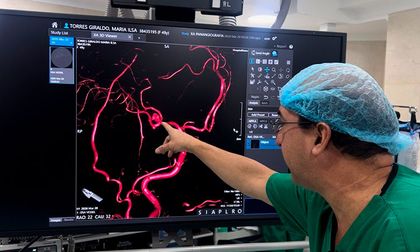 Nuevo angiógrafo de última tecnología en Cali
