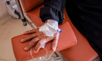 Identifican el ‘escudo’ de fibroblastos que protege al cáncer de hígado muy agresivo de la quimioterapia