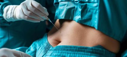 Imagen de  Mujer falleció en Medellín tras someterse a cirugía estética en quirófano clandestino; responsables están prófugos