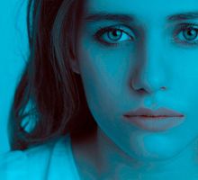 ¿Qué es el síndrome de la cara dormida?