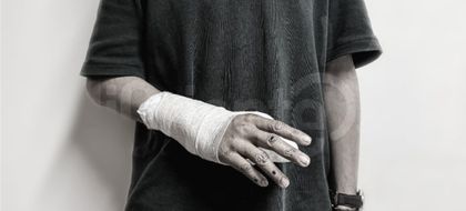 Imagen de  ¡Muy mal! Antioquia sumó 19 quemados por pólvora en Navidad, Oriente pasó de 7 a 14